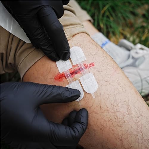 RHINO RESCUE Wound Closure Kit for Small Cuts, Burn Kit for Ⅰ& Ⅱ Degree Burns