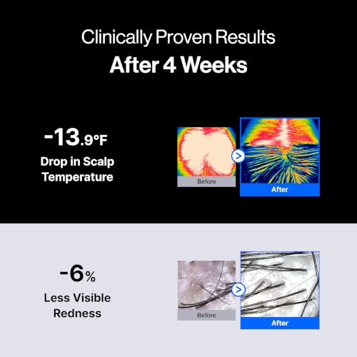Refilled cADPR Booster Plus Hair Growth Serum for Moisturizing Scalp Care Moisture