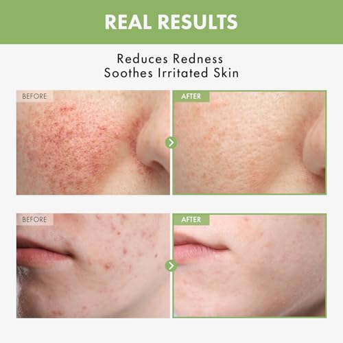 TOSOWOONG Heartleaf 97% Face Toner for Blemish-Prone & Calming, Hydrating