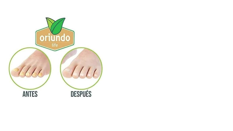Oriundo Natural Life Nail Treatment Solution, 9 Ingredients, 3 Month Supply - BeesActive Australia