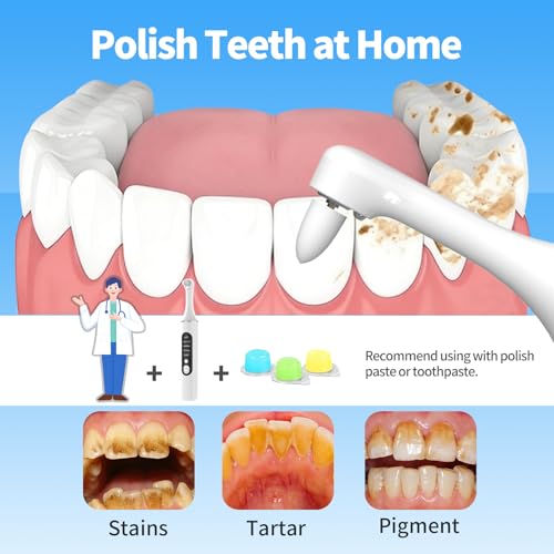 Tooth Polisher, Rechargeable Teeth Cleaning Tools for Tooth Polish and Whitening, Electric Teeth Cleaner with 3 Pastes, 5 Speeds, 6 Heads & LED Light, Waterproof Personal Dental Care Kit for Home Use White
