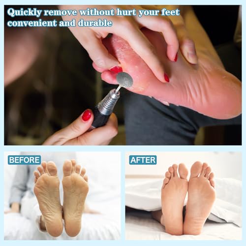 Pedicure Drill Bit, Diamond Carbide Foot Nail Drill Bit,Stainless Steel Professional Pedicure Foot Calluses Sanding Polishing Bits for Cracked Skin Callus Removal for Home Salon & DIY(Medium) Medium