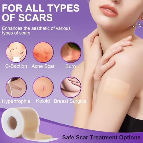 Silicone Scar Sheets, Medical Grade Silicone Scar Tape (1.6" x 120"), Professional Scar Removal Treatment, Reusable, for Healing Keloids, Surgeries Scars, C-sections, and Burns 1.6" x 120"