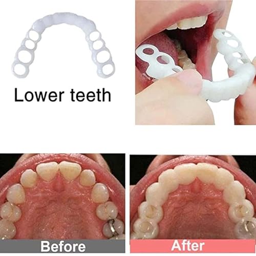 2 Pairs,Temporary Adjustable Smile Support, Comfortable & Secure, Top & Bottom Included.(White) (3)