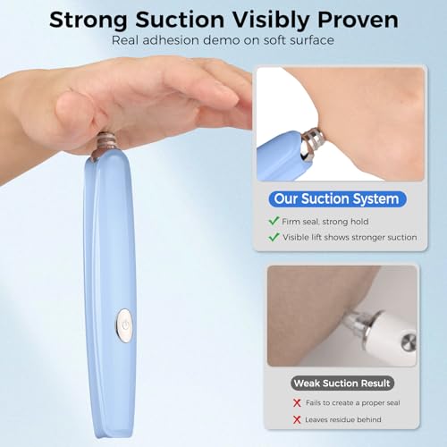 Tonsil Stone Remover Kit, Upgraded Rechargeable Tonsil Stone Vacuum with LED Light & Saliva Reservoir, Best Fast Painless Tonsillolith Removal Tool, Fight Bad Breath, Safe Silicone & 11 Attachments Blue