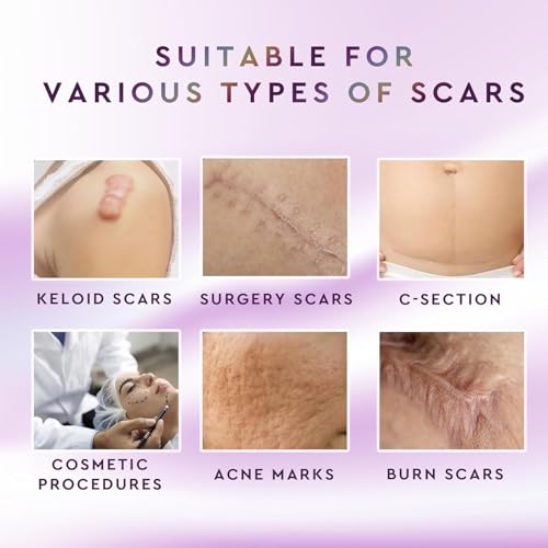 Advanced Silicone Scar Removal Cream – Professional Keloid Scar Treatment, Surgical Scars, C-Section, Hysterectomy, Mastectomy, Tummy Tuck, Acne Marks & Keloid Bump Removal Treatment – 30g 1 pack