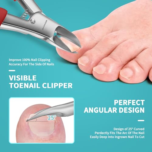 Toenail Clippers for Ingrown & Thick Toenails - Heavy Duty Toe Nail Clippers for Remove Side Ingrown Toenail with Angled Sharp Blades, Professional Pedicure Tool with Long Handle for Seniors & Men Paronychia Nemesis - Red Kit
