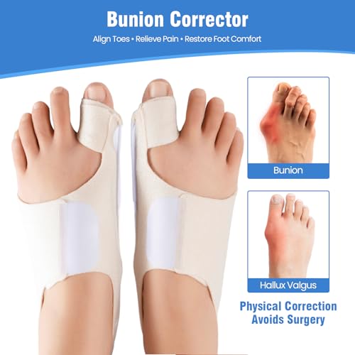 Bunion Corrector for Women Big Toe & Men – Adjustable Bunion Splint with Gel Pad for Bunion Relief – One Size Fits Most, 1 Pair
