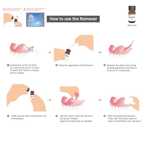E&E Denture Reline Silicone Remover_Effective silicone reliner removal from an acrylic denture. Quick 10 seconds!!!