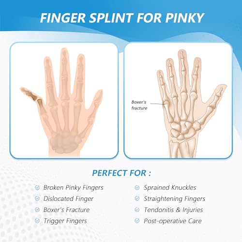 Pinky Finger Splint, Finger Splint for Pinky, Broken Finger, Trigger Finger, Metacarpal Splint Hand Brace, Little Finger Brace for Tendonnitis, Pain Relief, Fits for Left & Right Hand(S) Black S