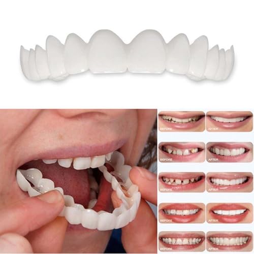 2 Pairs,Temporary Smile Solution, Adjustable & Comfortable.(White) (12)