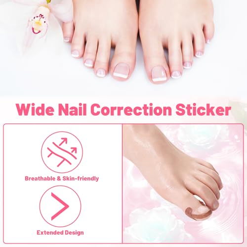 Ingrown Toenail Removal Kit Professional Ingrown Toenail Tool Kit with Ingrown Toenail Corrector, Corrector Patches, Toenail Clipper, Tools Stainless Steel Pedicure Tool Set
