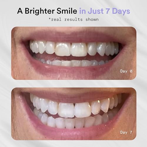 Teeth Whitening Strips, Professional Results, Mint 14ct