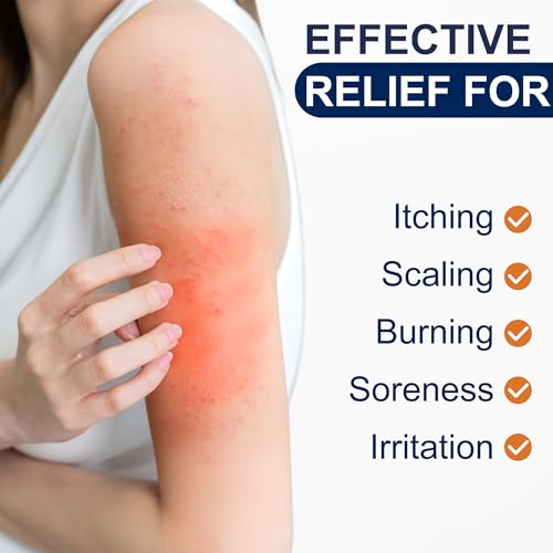 Antifungal Cream for Jock Itch, Athletes Foot & Ringworm - 2% Miconazole Nitrate Cream for Humans Skin Fungus, Relieves Itching, Burning, Cracking and Scaling (3.5 Ounce) 3.5 Ounce