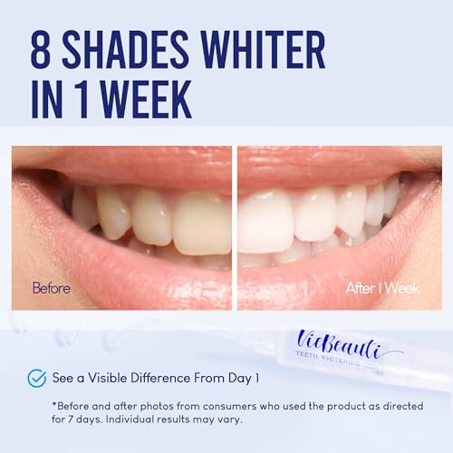 VieBeauti Ultimate Teeth Whitening Bundle - LED Whitening Kit and Whitening Pen Set, 35% Carbamide Peroxide, 5X LED Light, Mint Flavor, Effective, Painless, Travel-Friendly, Professional Results at Ho