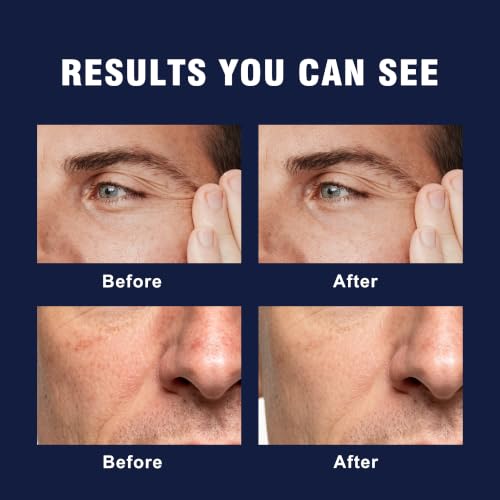 6-in-1 Face Cream for Men – Daily Hydrating Moisturizer for Age Defense