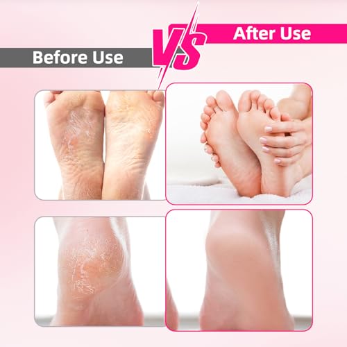 Cordless Electric Foot File & Callus Remover - Professional Pedicure Tool with 4 Nano Glass Grinding Heads, Dead Skin Remover for Cracked Heels and Rough Feet - Rechargeable Foot Sander