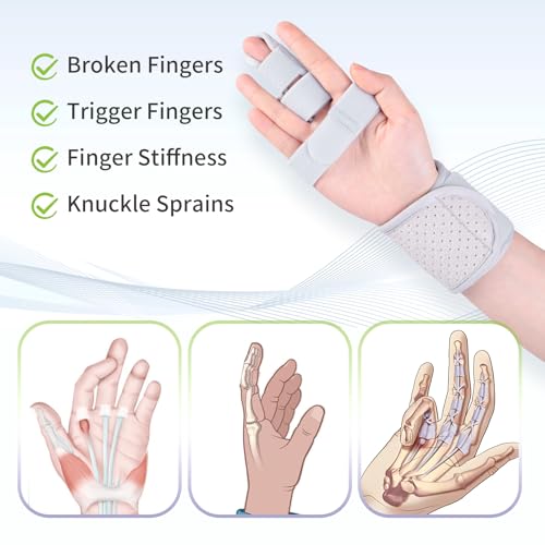 Trigger Finger Splint, Finger Brace Joint Stabilizer, Hand Brace with finger Support, Pinky Middle Pointer Fingers Splint, Broken Fingers Splint Single Grey 1