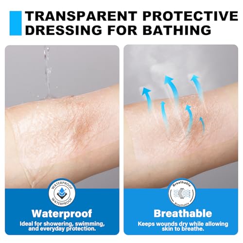 FRESINIDER Transparent Film Dressing 6” x 8” (50 Pack) – Large Waterproof Shower Bandages, Breathable Clear Wound Cover with Border for IV Shield, Post-Surgery Care & Tattoo Aftercare 6" x 8" 50