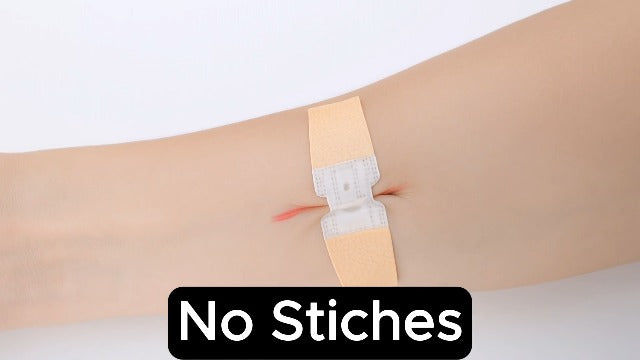 Zip Stitch, Wound Closure Kit, Butterfly Bandages, Zip Tie Bandages 4 Pack