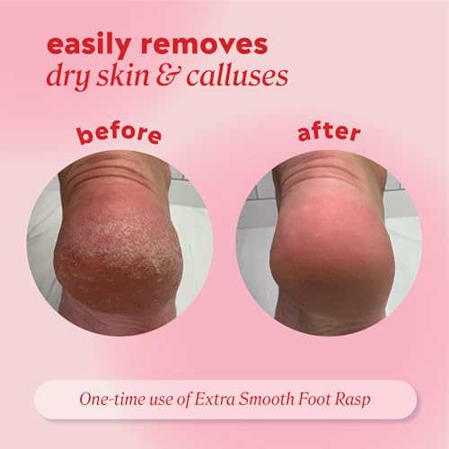 Onyx Professional Foot Rasp, No Mess Callus Remover for Feet, Includes Debris Catcher - Stainless Steel Foot Scrubber Dead Skin Remover, Lightweight Callus Shaver for Feet, Foot File, Pedicure Teal 1 Count (Pack of 1)