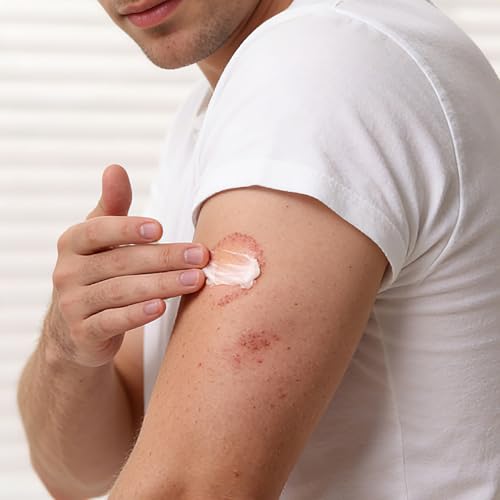 Antifungal Cream for Jock Itch, Athletes Foot & Ringworm - 2% Miconazole Nitrate Cream for Humans Skin Fungus, Relieves Itching, Burning, Cracking and Scaling (3.5 Ounce) 3.5 Ounce
