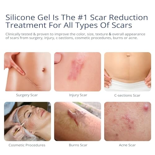 100% Silicone Scar Gel 2 Pack: 2 x 1.06oz Tubes for Surgical Scars, C-Section, Acne, Keloids, Burns, Stretch Marks – Advanced Scar Treatment for Old & New Scars 2 Count (Pack of 2)