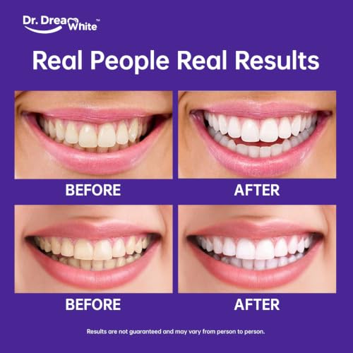Dr.DreamWhite Purple Teeth Whitening Strips Pap & mHAP, 3-Pack (21 Uses) 14 Count (Pack of 3)