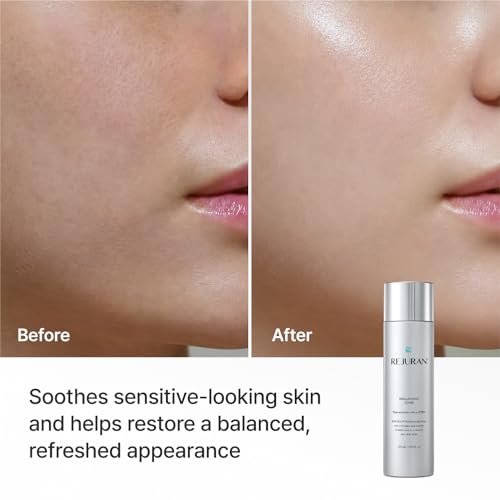 REJURAN Rebalancing Toner, c-PDRN® Hydrating & Soothing, 4.05 fl oz 4.05 Fl Oz (Pack of 1)