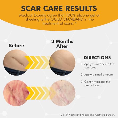 DermAvance Pure Scar Care - Silicone Scar Cream for Surgical Marks - 30g