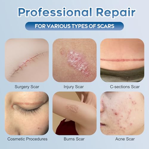 Advanced Silicone Scar Gel for Face & Body – Silicone Scar Cream for Old & New Scars, Reduces Appearance of Scars from Acne, Surgery, Burns, Injuries, C-Sections & More – 3.53 oz (100g) 3.53 Ounce