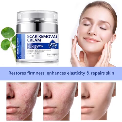 Scar Cream, Scar Removal Cream - Advanced Scar Cream for Surgical Scars, Acne Scars, C-Section, Burns, Stretch Marks -Effective for Old and New Scars Gel Acne Scar Treatment