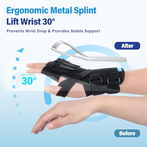 Radial Nerve Palsy Splint Wrist Drop Brace Fits Right & Left Hand