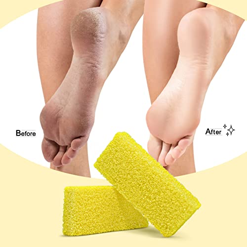 Disposable Foot Scrubber Sponge Pads Pedicure Pumice Stone for Feet Callus Remover Medium Coarse Yellow 40Pcs Yellow Medium Coarse