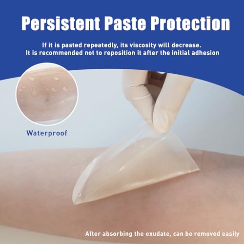Hydrocolloid Bandages 4"x4",10 Packs, Waterproof Self‑Adhesive Pad 4IN * 4IN-10 PCS