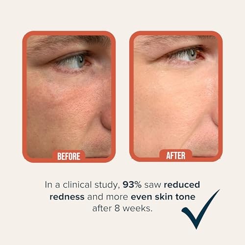 Cardon | Anti-Aging Face Moisturizer for Men | Korean Skincare Facial Lotion | Hydro Boost Gel | Healing Cactus Extract, Reduce Wrinkles, Repair Acne Scars | Ultra Light Face Cream (1 CT) Anti Aging Moisturizer 1.7 Fl Oz (Pack of 1)