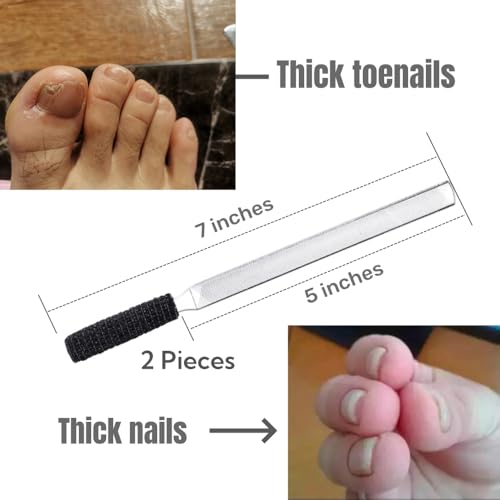 2PCS Toe Nail Files for Thick Nails, Heavy Duty Metal Nail File - SJ77