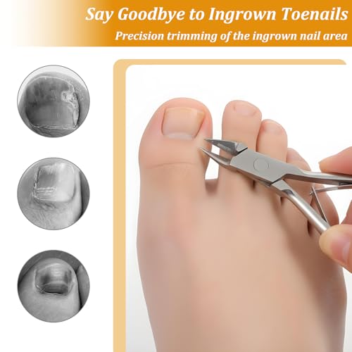 Ingrown Toenail Clipper, Straight Blade Toenail Clippers for Seniors Thick Nails Stainless Steel Ingrown Nail Clipper Ultra-Slim 16mm Blade Cuticle Cutters for Seniors Men Women Seniors