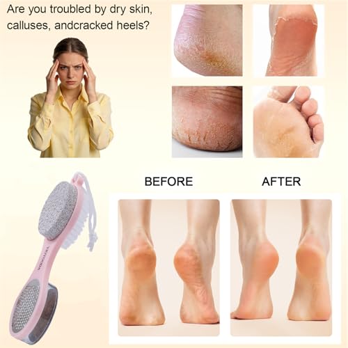 Foot Scrubber Brush with Pumice Stone for Feet Callus Remover Pedicure Tool Pink