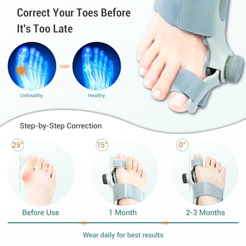 Bunion Corrector for Women Big Toe - US Patent 3 Precision Angles (0°/7.5°/15°) Adjustable Toe Straightener & Bunion Splint Brace with Extra Straps & Toe Separator, Fits Left & Right Foot, Large, Dark Brown 1 PCS