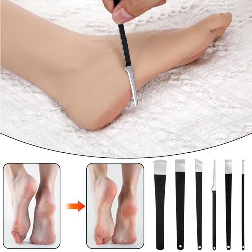 6 Pcs Ingrown Toenail Removal Kit, Pedicure Tools with Storage Box