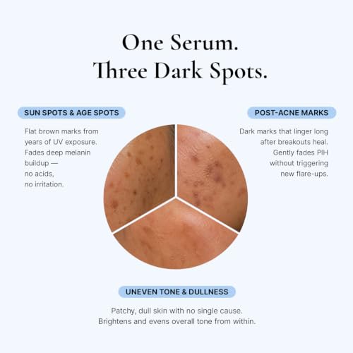 EnaSkin Dark Spot Corrector & Remover Serum for Face & Body, Niacinamide 1 Fl Oz (Pack of 1)