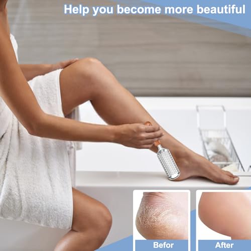 Professional Foot Scrubber Dead Skin Remover, Pedicure Foot File Callus Removal, Heel Scraper for Cracked Heels, Microplane Cheese Grater for Feet, Foot Rasp for Hard Skin(T1) T1