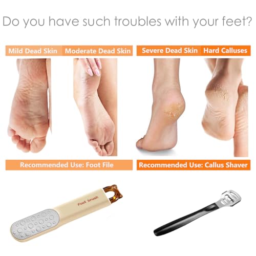 2-in-1 Foot File - Callus Shaver Skin Remover with 31 Blades - Stainless Steel Dual Sided Pedicure Feet Scrubber with Handle for Callus, Dry, Hard Dead Skin Removal - Heel Scraper Foot Care Tools