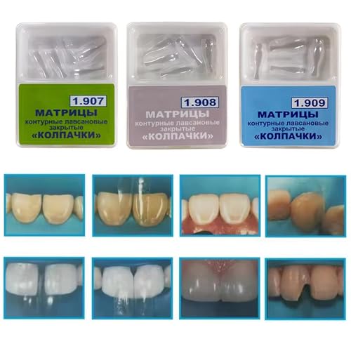 Dental Clear Matrix Bands, BT Anterior Matrices Bioclear Style, Diastema Transparent Sectional Matrice System (1908) 1908