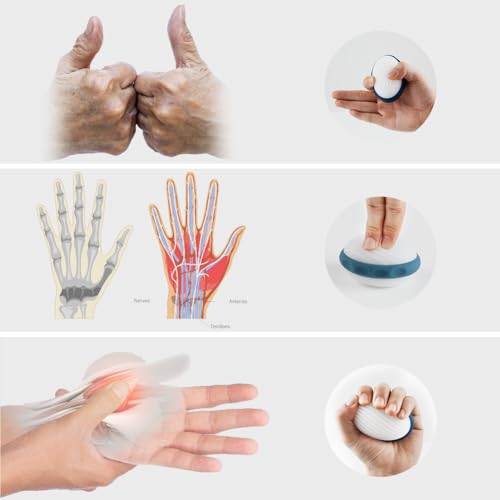 Remedic Hand Exerciser for Arthritis – Grip & Finger Strength Trainer