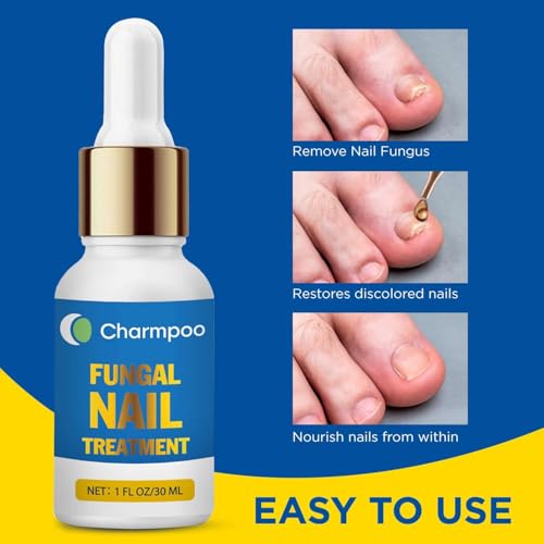 Toenail Fungus Treatment Extra Strength 30ml: Nail Cuticle Care Serum – Infused with Botanical Herbal Extracts for Clear Healthy-Looking Nails Lightweight Daily Nail & Toe Care