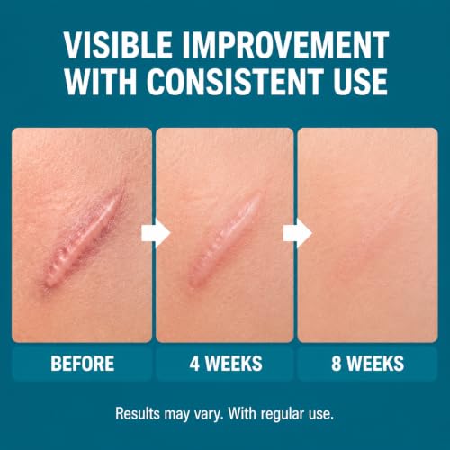 Scar Serum for Face & Body, Helps Improve the Appearance of Scars