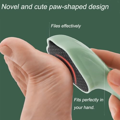 Hard Skin Remover Nano Glass Foot File - Foot Callus Remover with Handle Foot File Callus Remover with Nano-Level Grinding Points Durable Foot Scrubber Dead Skin Removal for Wet Dry Feet (Green) Green