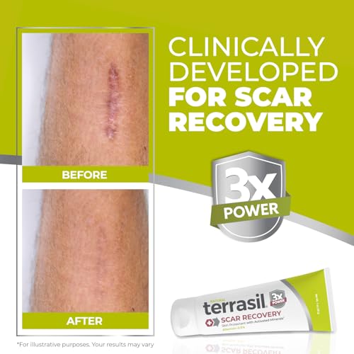 terrasil Scar Treatment Cream, Surgical & Acne Scars, 1oz